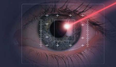 Láser- color de ojos- Strōma Medical